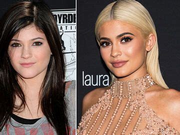 kylie vorher nachher|Kylie Jenner: Die Beauty